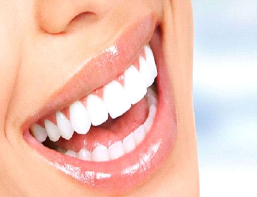 کامپوزیت کاریزما