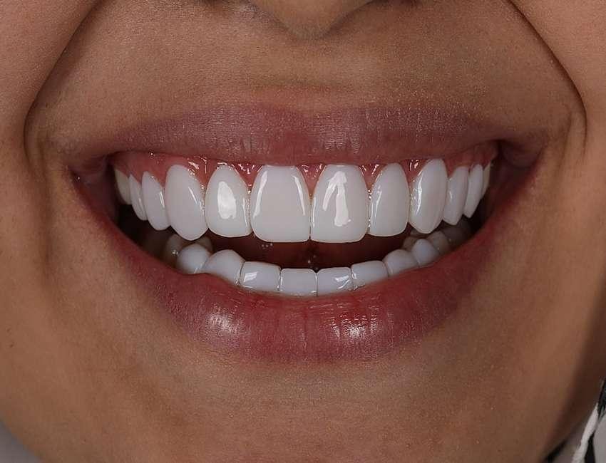 انتخاب کامپوزیت