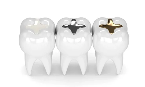 برندهای آمالگام