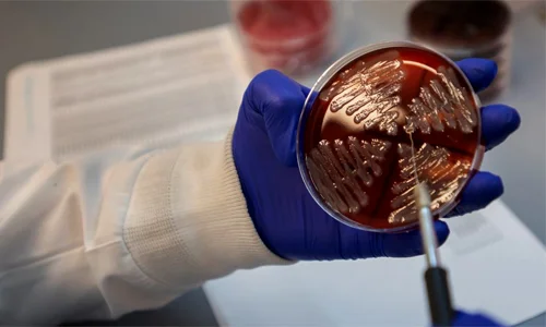 قیمت خرید محصول پاتولوژی 