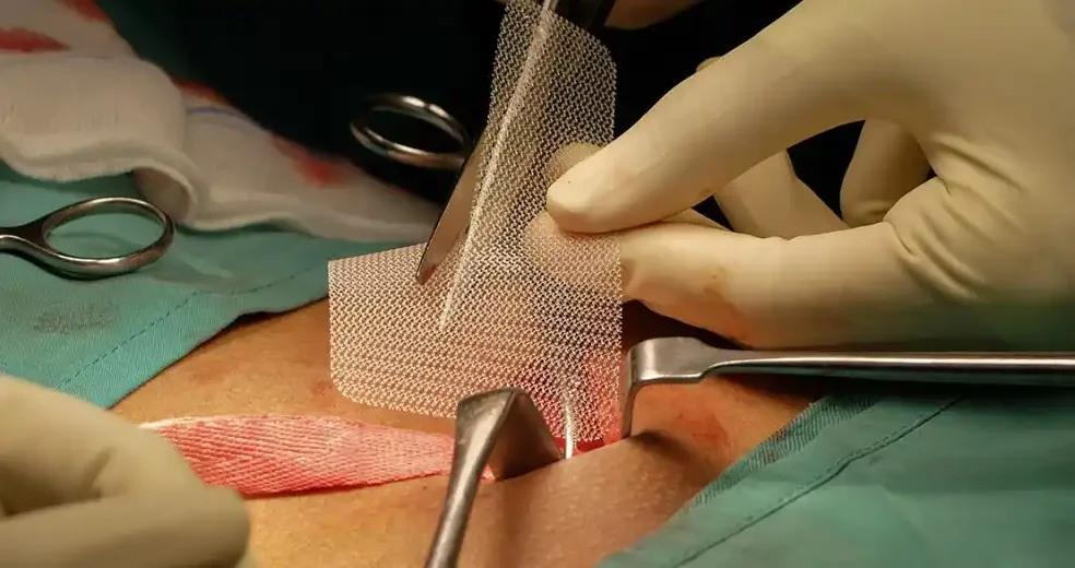 جراحی باکیفیت