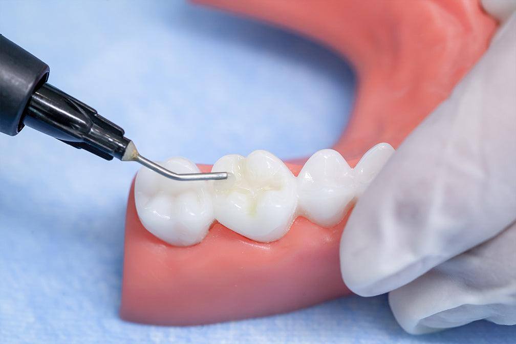کامپوزیت فلو چیست و چه تفاوتی با کامپوزیت معمولی دارد؟